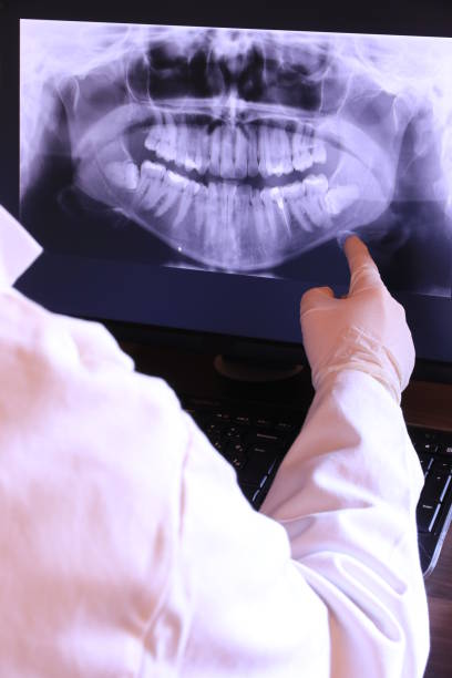 Best Knocked-Out Tooth (Avulsed Tooth) Treatment in Enterprise, NV