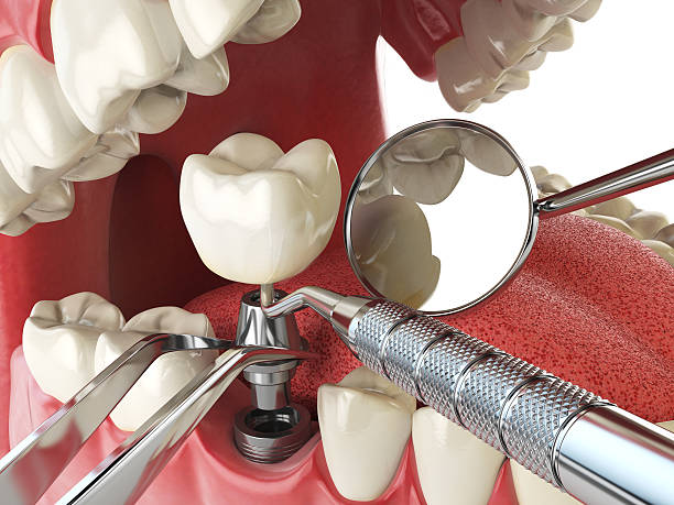 Best Emergency Denture Repair in Enterprise, NV