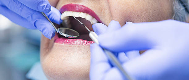 Best Broken or Chipped Tooth Repair in Enterprise, NV